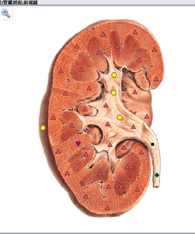 kidney 1.jpg