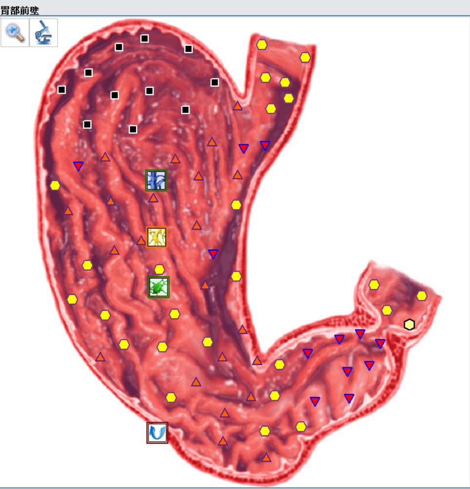 stomach 2.jpg