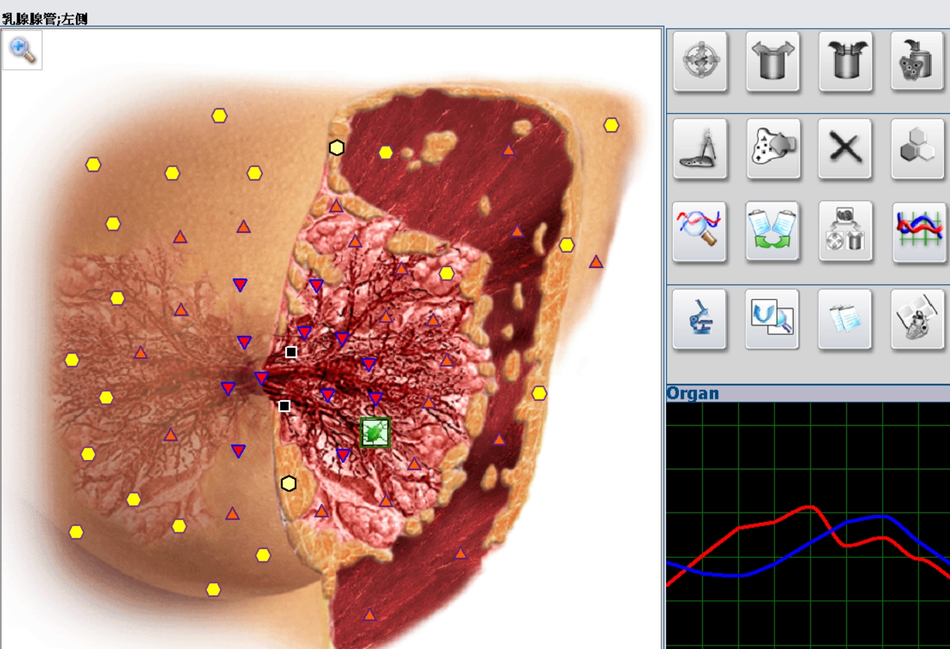 breast-4.jpg